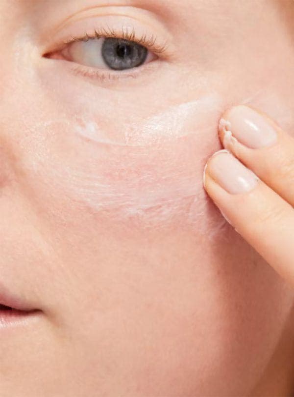 After Baume alternate